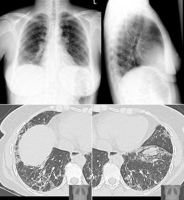 © Institut für Diagnostische, Interventionelle und Pädiatrische