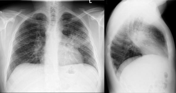 © Institut für Diagnostische, Interventionelle und Pädiatrische ...