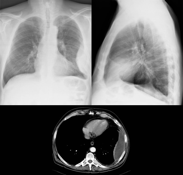 Thoraxröntgen Skelettröntgen Schädel-CT Abk. Hilfe Sitemap