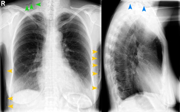 © Institut für Diagnostische, Interventionelle und Pädiatrische