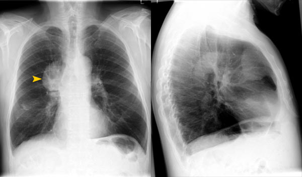 © Institut für Diagnostische, Interventionelle und Pädiatrische