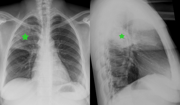 © Institut für Diagnostische, Interventionelle und Pädiatrische ...