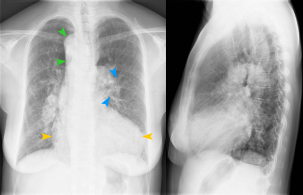 © Institut für Diagnostische Radiologie, UniversitätsSpital Zürich