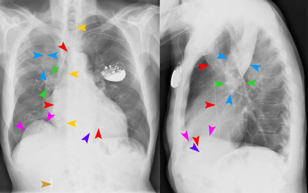 © Institut für Diagnostische Radiologie, UniversitätsSpital Zürich