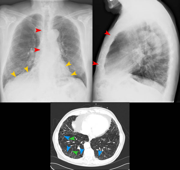 © Institut für Diagnostische Radiologie, UniversitätsSpital Zürich