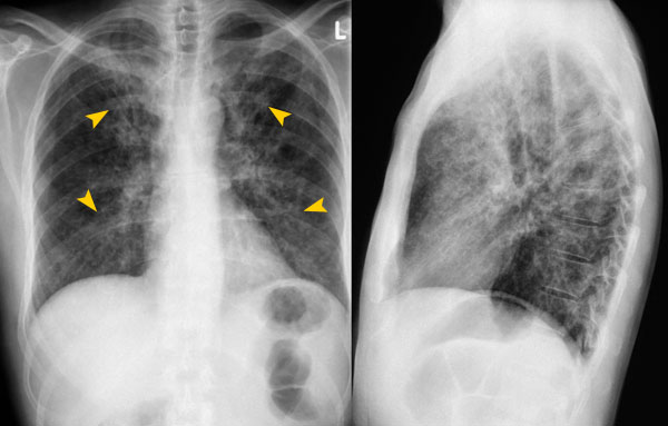 © Institut für Diagnostische Radiologie, UniversitätsSpital Zürich